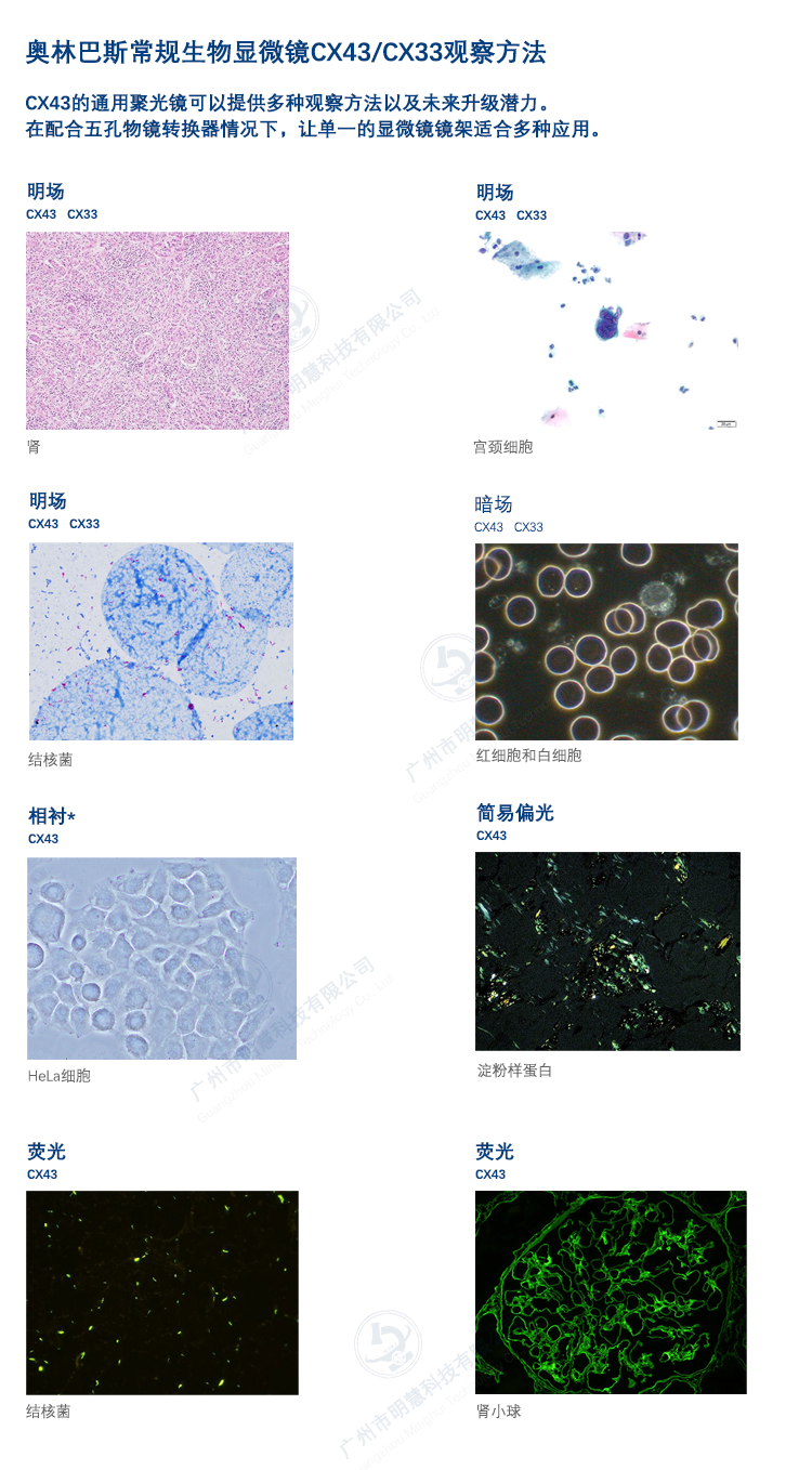 奧林巴斯常規(guī)生物顯微鏡CX43/CX33觀察方法2-廣州市明慧科技有限公司