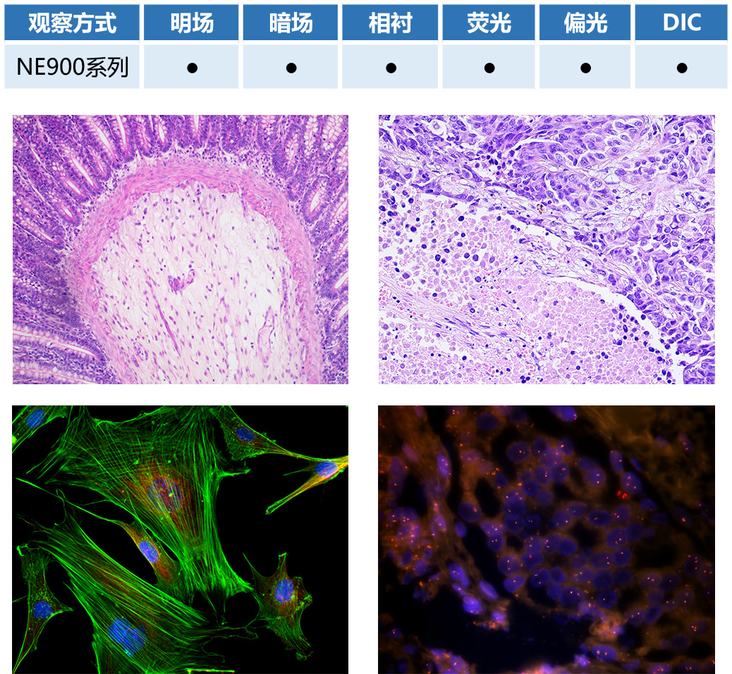 生物顯微鏡NE910成像效果圖正置生物顯微鏡NE910-廣州明慧