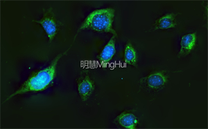 明慧的三色LED倒置熒光顯微鏡MHIF2000和高清顯微鏡攝像頭MHS900的結(jié)合，助力南科醫(yī)學(xué)大學(xué)進(jìn)行細(xì)胞多色熒光觀察。