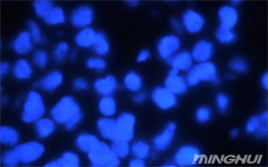 MINGHUI廣州明慧公司的熒光顯微鏡應(yīng)用于檢測her-2細(xì)胞