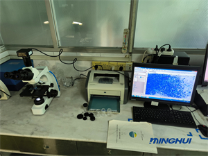 生物顯微鏡UB203i和顯微鏡攝像頭MHD600助力檢驗(yàn)科醫(yī)院檢測(cè)結(jié)核桿菌