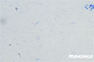 生物顯微鏡UB203i和顯微鏡攝像頭MHD600助力檢驗(yàn)科醫(yī)院檢測(cè)結(jié)核桿菌