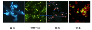明慧近期推出的BGU-LED-MH正置四孔三色LED熒光附件