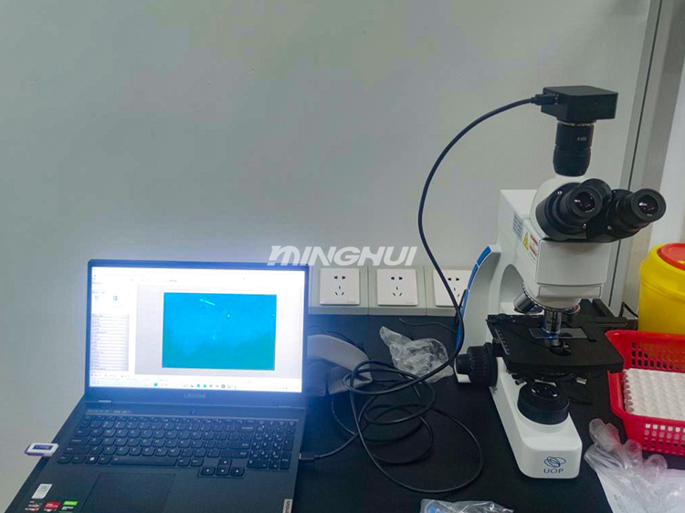 真菌熒光顯微鏡系統(tǒng)UB203i-FL和MHD600助力湖南某醫(yī)院真菌檢測