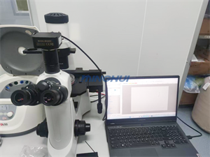 倒置顯微鏡MHIL200和MHD600相機(jī)應(yīng)用于食管鱗癌觀察（中山大學(xué)）