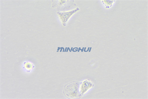 倒置顯微鏡MHIL200和MHD600相機(jī)應(yīng)用于食管鱗癌觀察（中山大學(xué)）