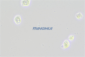 倒置顯微鏡MHIL200和MHD600相機(jī)應(yīng)用于食管鱗癌觀察（中山大學(xué)）